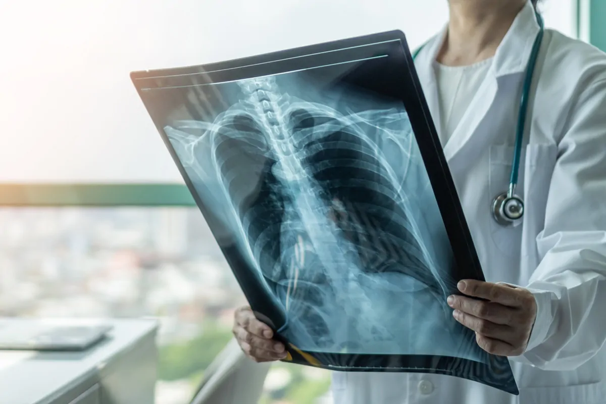 X-Ray