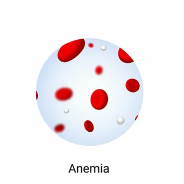 Anemia Profile