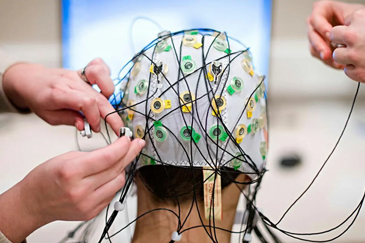 Electroencephalography (EEG)