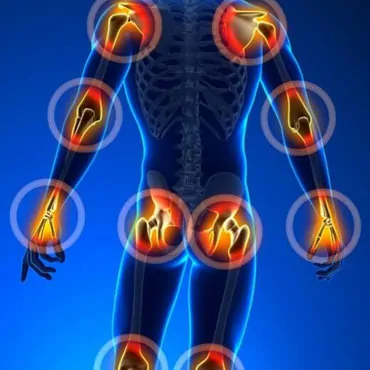 Arthritis Profile