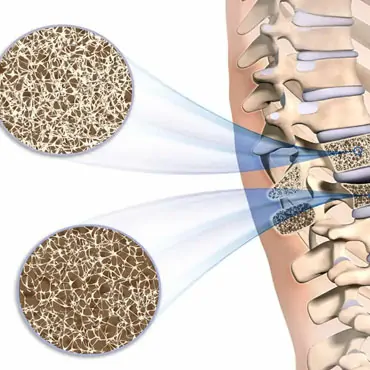 Bone & Mineral Package