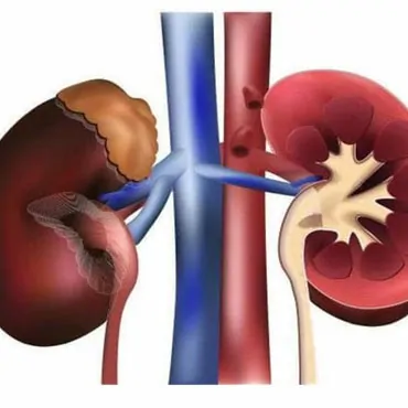 Renal (Kidney) Profile